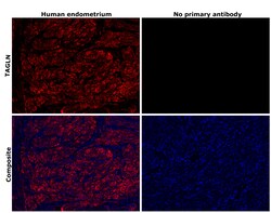 Invitrogen TAGLN Monoclonal Antibody (GT336) 100 &mu;L; Unconjugated:Antibodies,