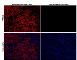 Invitrogen TAGLN Monoclonal Antibody (GT336) 100 &mu;L; Unconjugated:Antibodies,