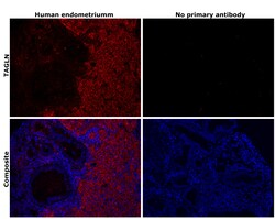 Invitrogen TAGLN Monoclonal Antibody (GT336) 100 &mu;L; Unconjugated:Antibodies,