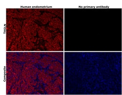 Invitrogen TAGLN Monoclonal Antibody (GT336) 100 &mu;L; Unconjugated:Antibodies,