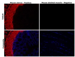 Invitrogen TAGLN Monoclonal Antibody (GT336) 100 &mu;L; Unconjugated:Antibodies,