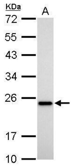 Invitrogen TAGLN Monoclonal Antibody (GT336) 100 &mu;L; Unconjugated:Antibodies,