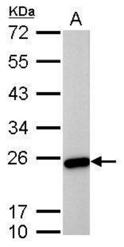 Invitrogen TAGLN Monoclonal Antibody (GT336) 100 &mu;L; Unconjugated:Antibodies,