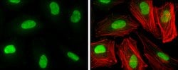 Invitrogen HMGB1 Monoclonal Antibody (GT348) 100 &mu;L; Unconjugated:Antibodies,