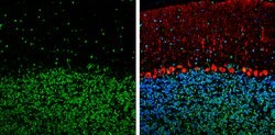 Invitrogen HMGB1 Monoclonal Antibody (GT348) 100 &mu;L; Unconjugated:Antibodies,