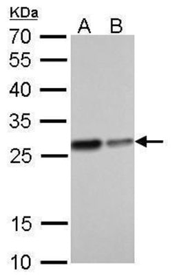 Invitrogen HMGB1 Monoclonal Antibody (GT348) 100 &mu;L; Unconjugated:Antibodies,