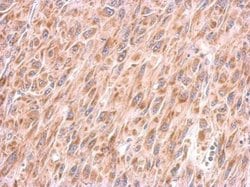 Invitrogen COX4 Monoclonal Antibody (GT6310) 100 &mu;L; Unconjugated:Antibodies,