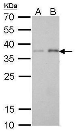 Invitrogen PEX19 Monoclonal Antibody (GT533) 100 &mu;L; Unconjugated:Antibodies,