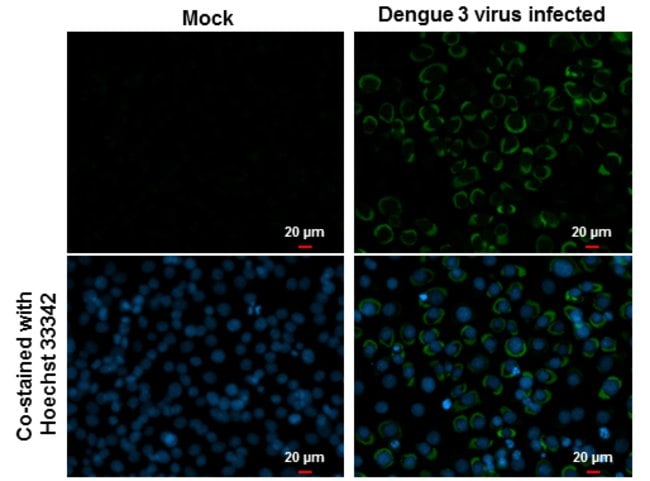 Invitrogen Dengue Virus Type 2 Envelope Monoclonal Antibody (GT214) 100 ...
