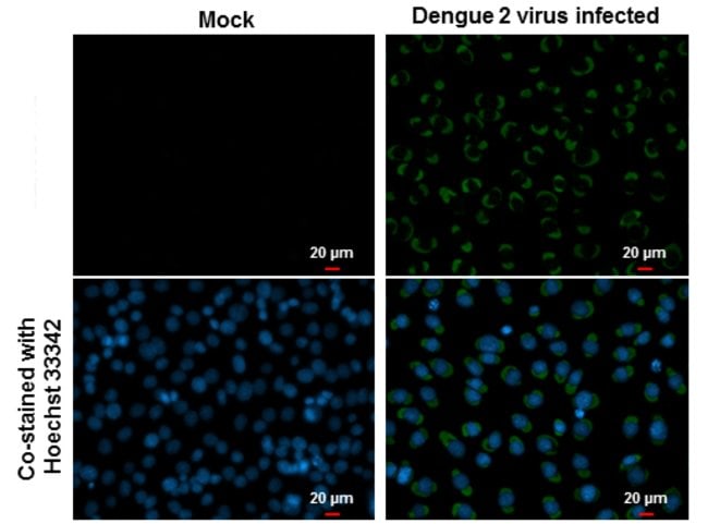Invitrogen Dengue Virus Type 2 Envelope Monoclonal Antibody (GT643) 100 ...