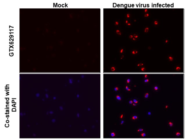 Invitrogen Dengue Virus Type 2 Envelope Monoclonal Antibody (GT643) 100 ...