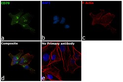 CD70 Monoclonal Antibody (BU69), Invitrogen 200 &mu;g; Unconjugated:Antibodies,