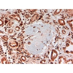 Invitrogen Complement C4d Monoclonal Antibody (LH61) 100 &mu;L; Unconjugated:Antibodies,