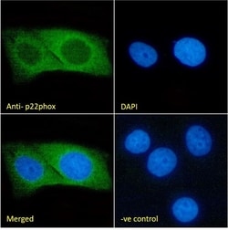 Invitrogen CYBA Monoclonal Antibody (CS9) 100 &mu;L; Unconjugated:Antibodies,
