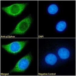 Invitrogen CYBA Monoclonal Antibody (CS9) 100 &mu;L; Unconjugated:Antibodies,