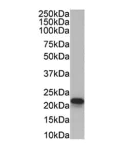 Invitrogen CYBA Monoclonal Antibody (CS9) 100 &mu;L; Unconjugated:Antibodies,