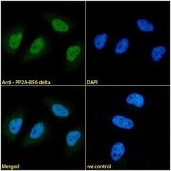 Invitrogen PPP2R5D Monoclonal Antibody (H5D12) 100 &mu;L | Buy Online | Invitrogen&trade; | Fisher Scientific