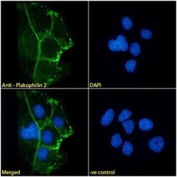Invitrogen PKP2 Monoclonal Antibody (8H6) 100 &mu;L; Unconjugated:Antibodies,