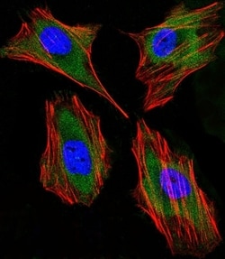 Invitrogen Lactoferrin Monoclonal Antibody (119CT80.1.1) 400 &mu;L; Unconjugated:Antibodies,