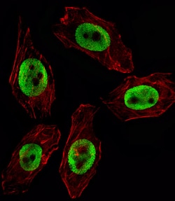 Invitrogen EZH2 Monoclonal Antibody (144CT2.1.1.5) 400 &mu;L; Unconjugated:Antibodies,