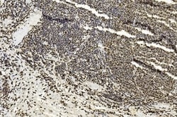 Invitrogen EZH2 Monoclonal Antibody (144CT2.1.1.5) 400 &mu;L; Unconjugated:Antibodies,