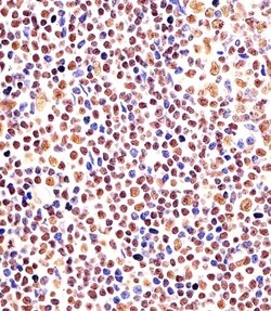 Invitrogen EZH2 Monoclonal Antibody (144CT2.1.1.5) 400 &mu;L; Unconjugated:Antibodies,