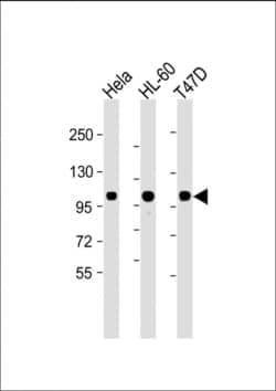 Invitrogen EZH2 Monoclonal Antibody (144CT2.1.1.5) 400 &mu;L; Unconjugated:Antibodies,