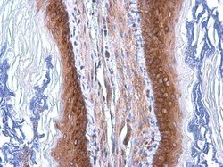 Invitrogen COPD Monoclonal Antibody (P1318) 100 &mu;L | Buy Online | Invitrogen&trade; | Fisher Scientific