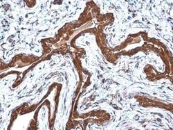 Invitrogen COPD Monoclonal Antibody (P1318) 100 &mu;L | Buy Online | Invitrogen&trade; | Fisher Scientific