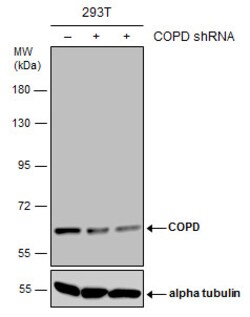 Invitrogen COPD Monoclonal Antibody (P1318) 100 &mu;L | Buy Online | Invitrogen&trade; | Fisher Scientific