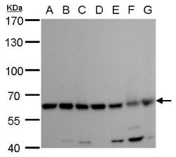 Invitrogen COPD Monoclonal Antibody (P1318) 100 &mu;L | Buy Online | Invitrogen&trade; | Fisher Scientific