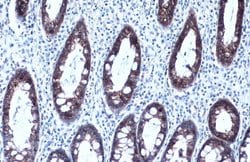 Invitrogen MCT1 Monoclonal Antibody (P14612) 100 &mu;L; Unconjugated:Antibodies,