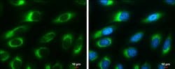Invitrogen RRBP1 Monoclonal Antibody (P1611) 100 &mu;L; Unconjugated:Antibodies,