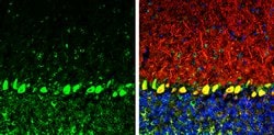 Invitrogen COPD Monoclonal Antibody (P189) 100 &mu;L; Unconjugated:Antibodies,