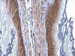 Invitrogen COPD Monoclonal Antibody (P189) 100 &mu;L; Unconjugated:Antibodies,