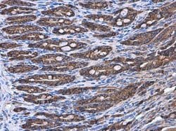 Invitrogen COPD Monoclonal Antibody (P189) 100 &mu;L; Unconjugated:Antibodies,