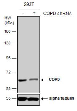Invitrogen COPD Monoclonal Antibody (P189) 100 &mu;L; Unconjugated:Antibodies,