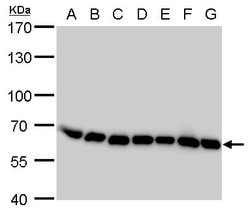 Invitrogen COPD Monoclonal Antibody (P189) 100 &mu;L; Unconjugated:Antibodies,