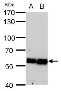 Invitrogen COPD Monoclonal Antibody (P189) 100 &mu;L; Unconjugated:Antibodies,