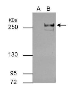 Invitrogen TET2 Monoclonal Antibody (P411) 100 &mu;L; Unconjugated:Antibodies,