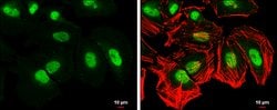 Invitrogen CAS Monoclonal Antibody (P5111) 100 &mu;L; Unconjugated:Antibodies,