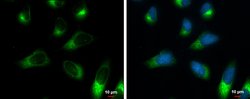Invitrogen RRBP1 Monoclonal Antibody (P5610) 100 &mu;L; Unconjugated:Antibodies,