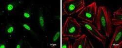 Invitrogen CAS Monoclonal Antibody (P729) 100 &mu;L; Unconjugated:Antibodies,