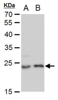 Invitrogen LIN7A Monoclonal Antibody (P879) 100 &mu;L; Unconjugated:Antibodies,