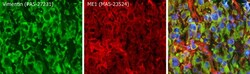 Invitrogen ME1 Monoclonal Antibody (3I6) 100 &mu;L; Unconjugated:Antibodies,