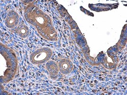 Invitrogen ME1 Monoclonal Antibody (3I6) 100 &mu;L; Unconjugated:Antibodies,