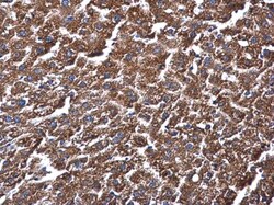 Invitrogen ME1 Monoclonal Antibody (3I6) 100 &mu;L; Unconjugated:Antibodies,