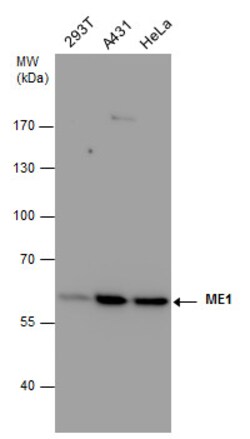 Invitrogen ME1 Monoclonal Antibody (3I6) 100 &mu;L; Unconjugated:Antibodies,