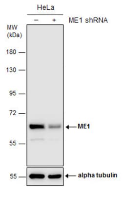 Invitrogen ME1 Monoclonal Antibody (3I6) 100 &mu;L; Unconjugated:Antibodies,
