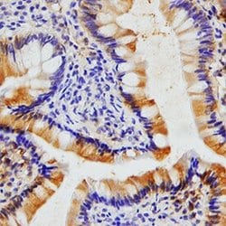 Invitrogen Eotaxin Monoclonal Antibody (43911) 100 &mu;g; Unconjugated:Antibodies,